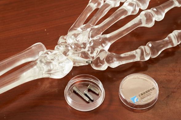 2021－「促進組織整合仿生3D列印技術」以3D列印打造出「仿生中空骨釘」，可製作不同規格、多孔隙的骨釘、椎間融合器等植入骨材，精準修復患者健康。
