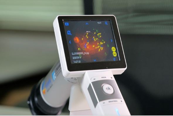 「糖尿病視網膜病變AI輔助診斷與偵測技術」能自動偵測標示出微血管瘤以及出血、軟滲出物、硬滲出物等4種眼底主要病徵。